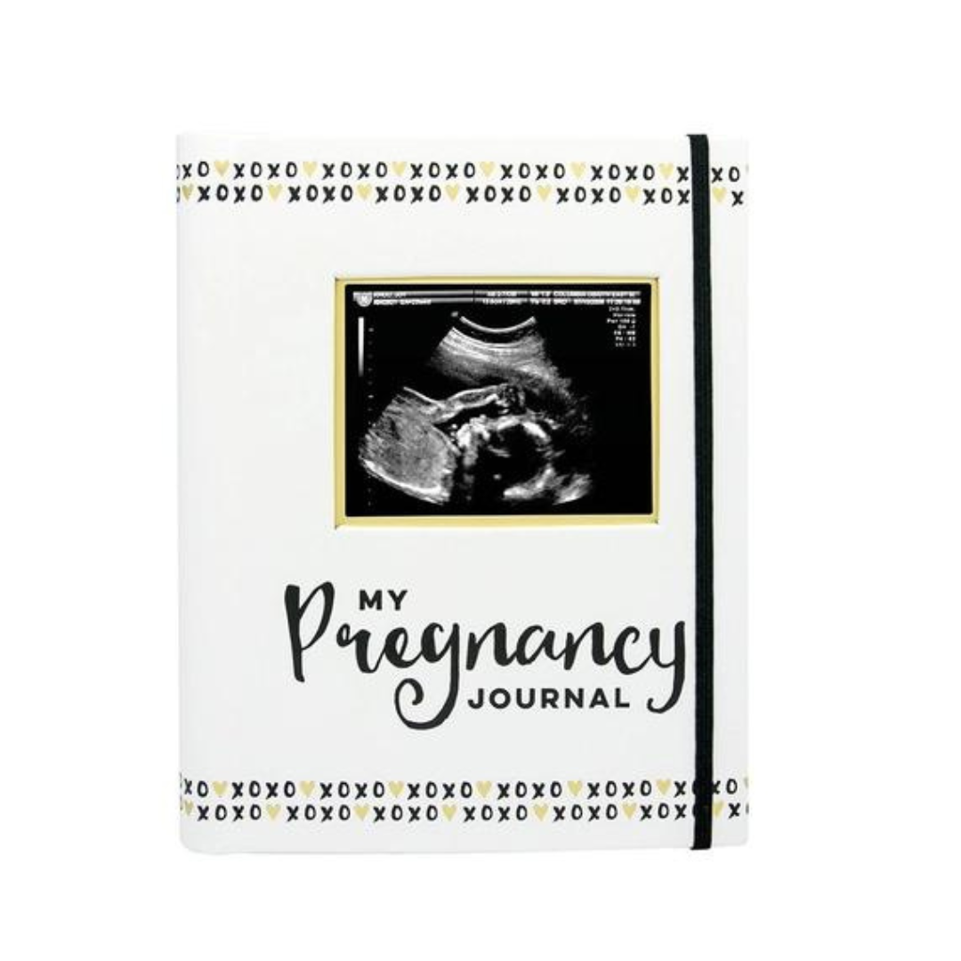 Black, White, & Gold Pregnancy Journal
