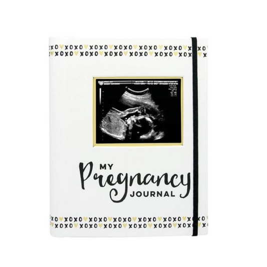 Black, White, & Gold Pregnancy Journal
