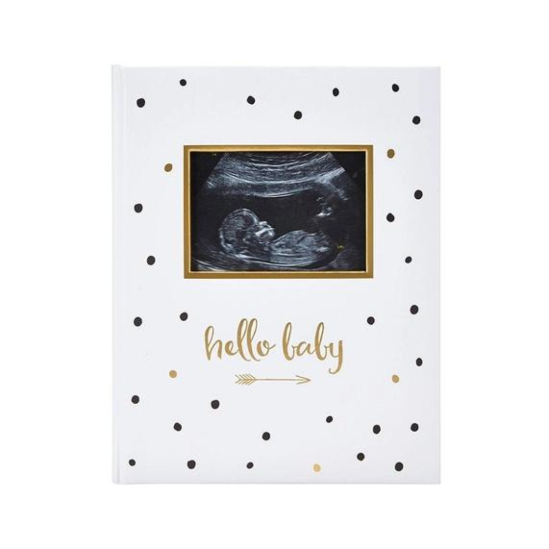 Black & Gold Hello Baby Book